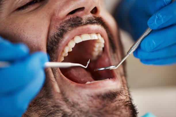 Best After-Hours Dental Trauma Care in Wapakoneta, OH